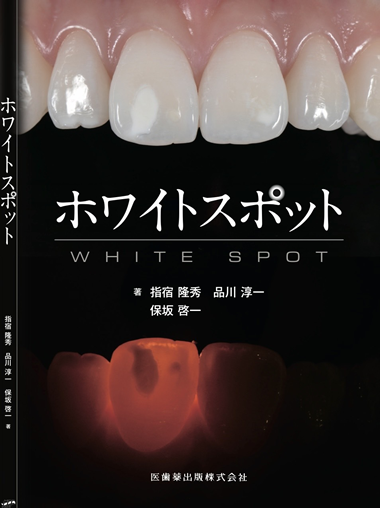 Specialized Book on White Spots